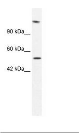 Jurkat Cell Lysate