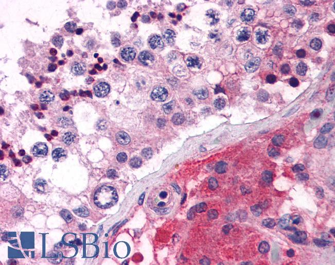 Anti-ELOVL5 antibody LS-A9855 IHC of human testis. Immunohistochemistry of formalin-fixed, paraffin-embedded tissue after heat-induced antigen retrieval.
