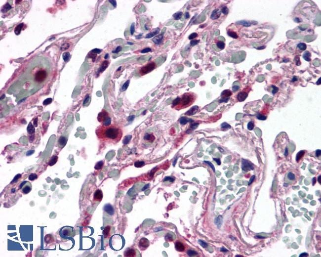 Anti-ELOVL5 antibody LS-A9855 IHC of human lung. Immunohistochemistry of formalin-fixed, paraffin-embedded tissue after heat-induced antigen retrieval.