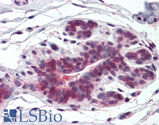 Anti-ELOVL5 antibody LS-A8398 IHC of human breast. Immunohistochemistry of formalin-fixed, paraffin-embedded tissue after heat-induced antigen retrieval.