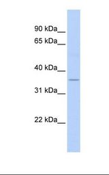Fetal heart lysate. Antibody concentration: 1.0 ug/ml. Gel concentration: 12%.