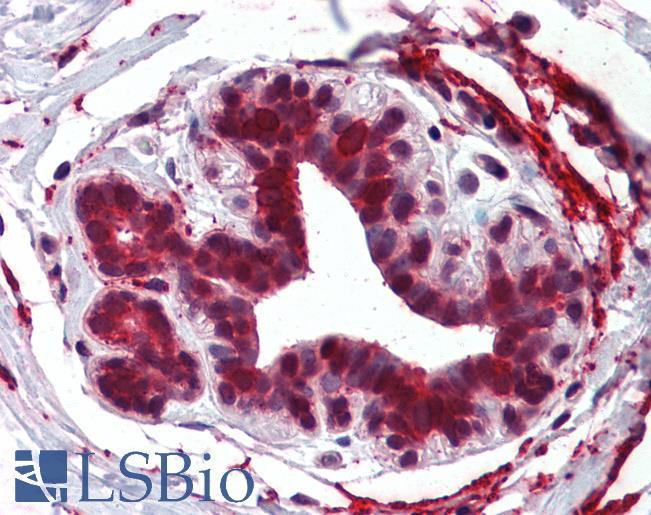 Anti-ELOVL5 antibody LS-A8396 IHC of human breast. Immunohistochemistry of formalin-fixed, paraffin-embedded tissue after heat-induced antigen retrieval.
