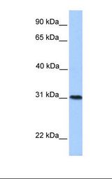 MCF7 cell lysate. Antibody concentration: 1.0 ug/ml. Gel concentration: 12%.