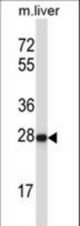 HELT Antibody western blot of mouse liver tissue lysates (35 ug/lane). The HELT antibody detected the HELT protein (arrow).