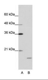 A: Marker, B: Daudi Cell Lysate