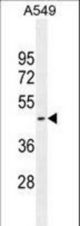 HEMK1 Antibody western blot of A549 cell line lysates (35 ug/lane). The HEMK1 antibody detected the HEMK1 protein (arrow).