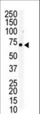 Western blot of anti-EphB6 C-term antibody in Jurkat cell lysate. EphB6 (arrow) was detected using purified antibody. Secondary HRP-anti-rabbit was used for signal visualization with chemiluminescence.