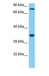 Western blot of MGAT5 Antibody with human OVCAR-3 Whole Cell lysate.