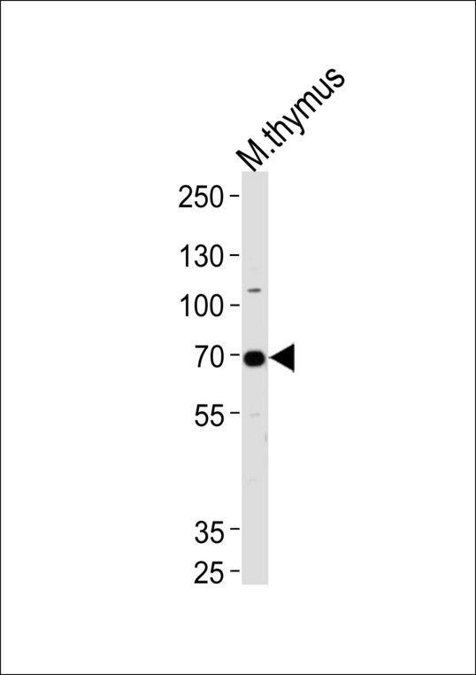 Western blot of lysate from mouse thymus tissue lysate, using Mouse Ephb6 Antibody. Antibody was diluted at 1:1000 at each lane. A goat anti-rabbit IgG H&L (HRP) at 1:5000 dilution was used as the secondary antibody. Lysate at 35ug per lane.