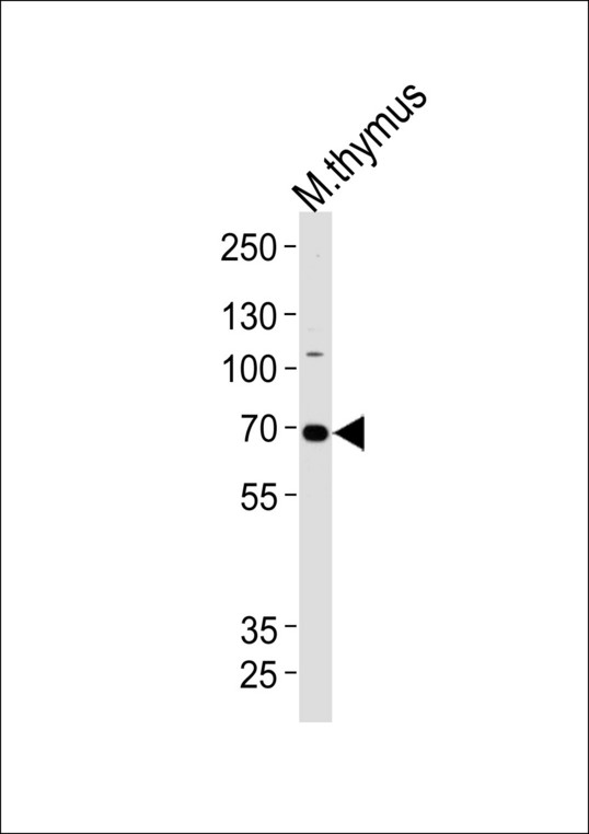 Western blot of lysate from mouse thymus tissue lysate, using Mouse Ephb6 Antibody. Antibody was diluted at 1:1000 at each lane. A goat anti-rabbit IgG H&L (HRP) at 1:5000 dilution was used as the secondary antibody. Lysate at 35ug per lane.