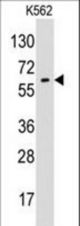 Western blot of anti-GPC6 antibody in K562 cell line lysates (35 ug/lane). GPC6(arrow) was detected using the purified antibody.