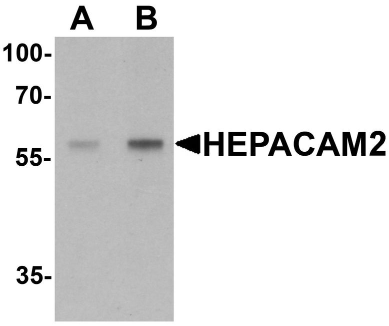 Western blot analysis of HEPACAM2 in mouse brain tissue lysate with HEPACAM2 antibody at (A) 0.5 ug/ml and (B) 1 ug/ml.