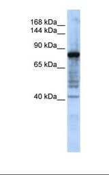 MCF7 cell lysate. Antibody concentration: 1.0 ug/ml. Gel concentration: 6-18%.