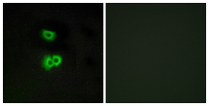 Immunofluorescence of A549 cells, using GPR101 Antibody. The sample on the right was incubated with synthetic peptide.