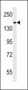 HEPHL1 Antibody western blot of K562 cell line lysates (35 ug/lane). The HEPHL1 antibody detected the HEPHL1 protein (arrow).