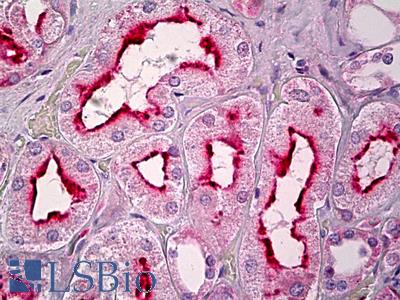 Anti-GPR101 antibody IHC of human kidney, tubules. Immunohistochemistry of formalin-fixed, paraffin-embedded tissue after heat-induced antigen retrieval. Antibody LS-B6713 concentration 10 ug/ml.