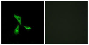 Immunofluorescence of HeLa cells, using GPR101 Antibody. The picture on the right is treated with the synthesized peptide.