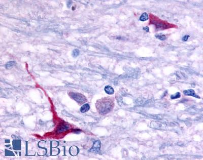 Anti-GPR101 antibody LS-A8066 IHC of human brain, hypothalamus. Immunohistochemistry of formalin-fixed, paraffin-embedded tissue after heat-induced antigen retrieval.