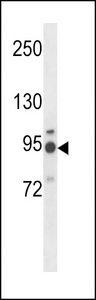 MGAT5 Antibody western blot of NCI-H460 cell line lysates (35 ug/lane). The MGAT5 antibody detected the MGAT5 protein (arrow).