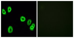 Immunofluorescence of HUVEC cells, using GPR18 Antibody. The picture on the right is treated with the synthesized peptide.