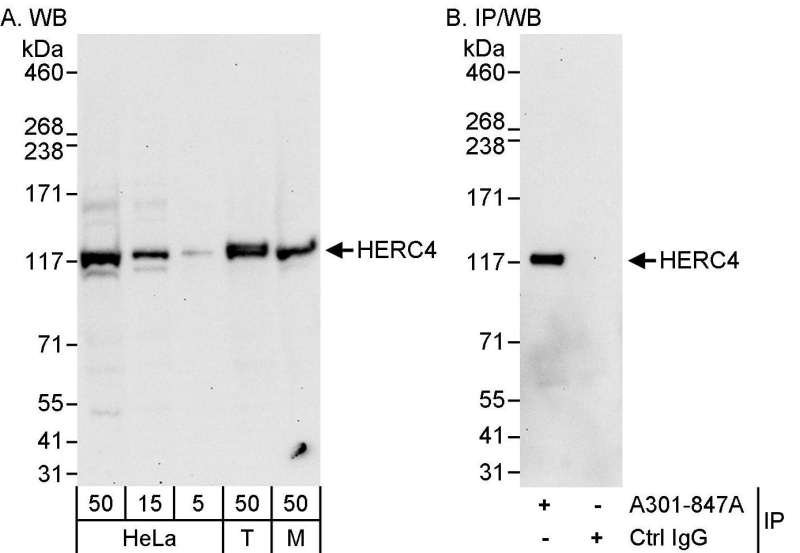Detection of Human and Mouse HERC4 by Western Blot (h&m) and Immunoprecipitation (h). Samples: Whole cell lysate from HeLa (5, 15 and 50 ug for WB; 1 mg for IP, 20% of IP loaded), 293T (T; 50 ug), and mouse NIH3T3 (M; 50 ug) cells. Antibodies: Affinity purified rabbit anti-HERC4 antibody used for WB at 0.1 ug/ml (A) and 1 ug/ml (B) and used for IP at 3 ug/mg lysate. Detection: Chemiluminescence with exposure times of 30 seconds (A and B).