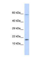 HERC4 antibody LS-C135125 Western blot of Fetal Liver lysate. Antibody concentration 1 ug/ml.
