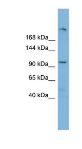 HERC4 antibody LS-C107994 Western blot of ACHN lysate.