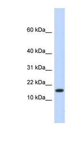 HERC4 antibody LS-C110740 Western blot of Fetal Liver lysate.
