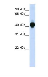 Fetal muscle lysate. Antibody concentration: 1.0 ug/ml. Gel concentration: 12%.