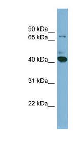 HERPUD2 antibody LS-C107966 Western blot of NCI-H226 cell lysate.