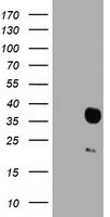 HEK293T cells were transfected with the pCMV6-ENTRY control (Left lane) or pCMV6-ENTRY HES1 (Right lane) cDNA for 48 hrs and lysed. Equivalent amounts of cell lysates (5 ug per lane) were separated by SDS-PAGE and immunoblotted with anti-HES1.