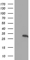 HEK293T cells were transfected with the pCMV6-ENTRY control (Left lane) or pCMV6-ENTRY HES1 (Right lane) cDNA for 48 hrs and lysed. Equivalent amounts of cell lysates (5 ug per lane) were separated by SDS-PAGE and immunoblotted with anti-HES1.