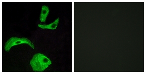 Immunofluorescence of HeLa cells, using GPR18 Antibody. The picture on the right is treated with the synthesized peptide.