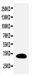 WB of HES1 / HES-1 antibody. WB: Rat Kidney Tissue Lysate.