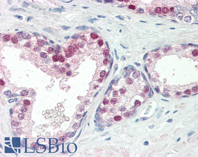 Anti-HES4 antibody IHC of human prostate. Immunohistochemistry of formalin-fixed, paraffin-embedded tissue after heat-induced antigen retrieval. Antibody LS-B3076 concentration 10 ug/ml.