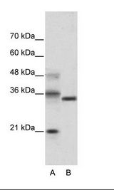 A: Marker, B: Transfected 293T Cell Lysate