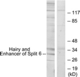 Western blot of extracts from HeLa cells, using HES6 Antibody. The lane on the right is treated with the synthesized peptide.