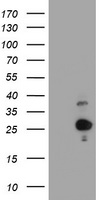 HEK293T cells were transfected with the pCMV6-ENTRY control (Left lane) or pCMV6-ENTRY HES6 (Right lane) cDNA for 48 hrs and lysed. Equivalent amounts of cell lysates (5 ug per lane) were separated by SDS-PAGE and immunoblotted with anti-HES6.