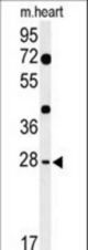 Western blot of HES7 Antibody in mouse heart tissue lysates (35 ug/lane). HES7 (arrow) was detected using the purified antibody.