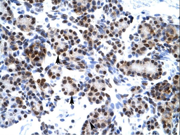 HES7 antibody LS-C29784 was used in IHC to stain formalin-fixed, paraffin-embedded human pancreas.