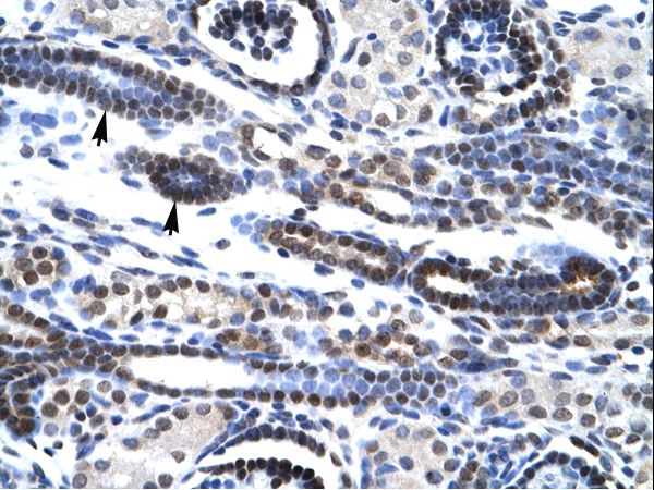 HES7 antibody LS-C29784 was used in IHC to stain formalin-fixed, paraffin-embedded human kidney.