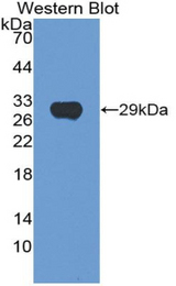 Western blot of recombinant HEXA.