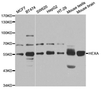 Western blot analysis of extracts of various cell lines, using HEXA antibody.