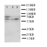 WB of HEXA antibody. Lane 1: Rat Liver Tissue Lysate. Lane 2: HELA Cell Lysate . Lane 3: SMMC Cell Lysate.