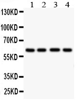 HEXA antibody Western blot. All lanes: Anti HEXA at 0.5 ug/ml. Lane 1: Human Placenta Tissue Lysate at 50 ug. Lane 2: HELA Whole Cell Lysate at 40 ug. Lane 3: HEPG2 Whole Cell Lysate at 40 ug. Lane 4: U87 Whole Cell Lysate at 40 ug. Predicted band size: 61 kD. Observed band size: 61 kD.
