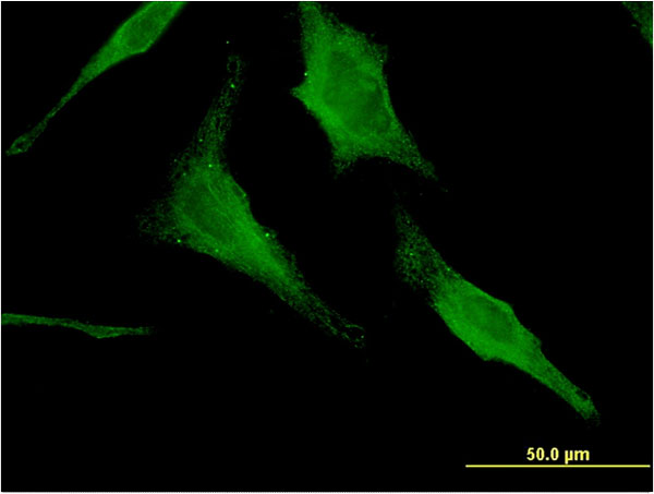 Immunofluorescence of monoclonal antibody to HEXA on HeLa cell . [antibody concentration 10 ug/ml]