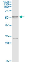 HEXA monoclonal antibody (M06), clone 3D1. Western Blot analysis of HEXA expression in human kidney.