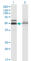 Western Blot analysis of HEXA expression in transfected 293T cell line by HEXA monoclonal antibody (M06), clone 3D1.Lane 1: HEXA transfected lysate(60.7 KDa).Lane 2: Non-transfected lysate.