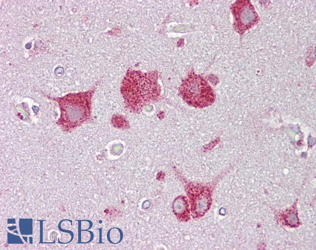 Anti-HEXA antibody IHC of human brain, cortex. Immunohistochemistry of formalin-fixed, paraffin-embedded tissue after heat-induced antigen retrieval. Antibody LS-B6959 concentration 5 ug/ml.