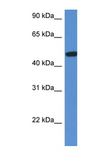 HEXA antibody LS-B6959 Western blot of Fetal Kidney lysate. Antibody concentration 1 ug/ml.